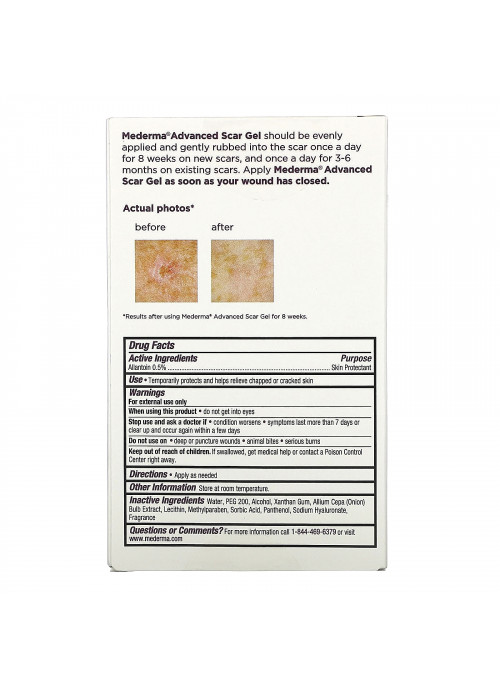 Mederma, Advanced Scar Gel, 1.76 oz (50 g)