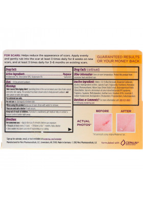 Mederma, Scar Cream, +SPF 30, 0.70 oz (20 g)